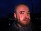 Кровавое избиение вернувшегося из Донбасса военнослужащего совершили торговцы в Киеве