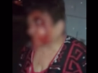 Жительница Кишинева была жестоко избита пьяным мужем 