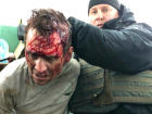 «Блестящая спецоперация»: окровавленный террорист задержан, все харьковские заложники освобождены