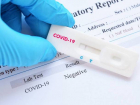Люди с симптомами коронавируса смогут сделать экспресс-тест на антиген SARS-CoV-2 бесплатно