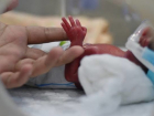 Молдавские врачи спасли ребенка с экстремально низким весом