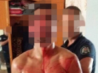 Кровавую расправу над своим пенисом совершил наркоман из Тирасполя
