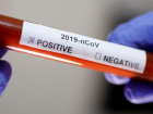 Срочно! В Молдове подтверждены два новых случая коронавируса