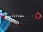 Сотни людей стоят в очереди в частные лаборатории - хотят узнать, больны ли коронавирусом