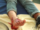Девушка, сбитая маршруткой на зебре в Кишиневе, получила перелом ноги