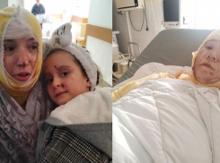 18+ Мужчина облил кислотой своих супругу и дочь (фото)