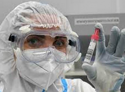 В Молдове выявлено 466 новых случаев COVID-19  