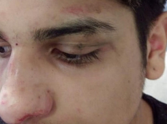 Манчестерские подростки избили смуглого школьника-мигранта из Румынии 