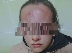 Избиение школьницы в Яловенском районе: виновным грозит реальный срок