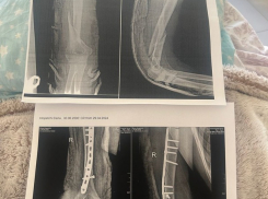 18+ В центре Кишинева наркоман изуродовал девушку