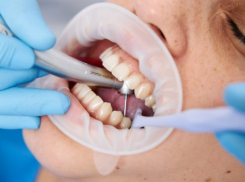 До 10 человек в год погибают в Молдове из-за нелеченных зубных инфекций