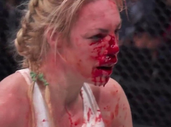 «Кровавое месиво»: ужасную травму блондинки сняли на видео