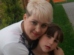 Многочисленные рваные раны: голову семилетней одесситки искусал алабай