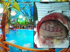 «Ребенку наложили 34 шва»: мать рассказала о трагедии с мальчиком в киевском аквапарке