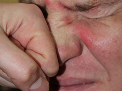 Ревнивец сломал нос соседу своей девушки по съемной квартире в Бендерах, решив, что он ее любовник 