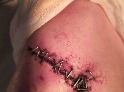 Муж-психопат облил жену и дочь кислотой: появились новые подробности нашумевшей истории