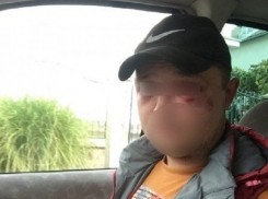 Жгите им машины, а их бросайте в канаву, - на Украине началась война за грибы 