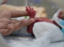 Молдавские врачи спасли ребенка с экстремально низким весом