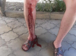 Полицейские отказались помочь парню, которого сбил автомобиль