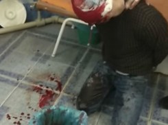 Окровавленный мужчина напал на медиков одесской скорой помощи и попал на видео