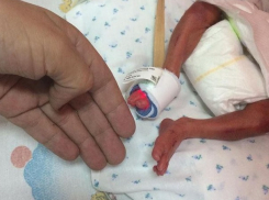 Одесские врачи перепутали пол родившейся удивительно маленькой девочки