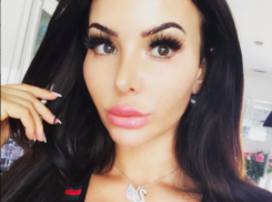 Любительницу пластической хирургии ужаснули ее новые слишком большие ягодицы: «они двигаются»