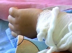 Пятилетняя девочка перевернула на себя чайник с кипятком в Приднестровье