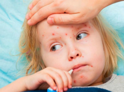 Более тридцати детей скончалось от эпидемии кори в Румынии