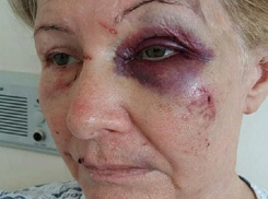 Жестокое избиение известного в Кишиневе врача совершил вооруженный солдат Французского легиона