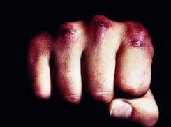 Смерть от кулаков своего сына: 66-летняя женщина скончалась после избиения