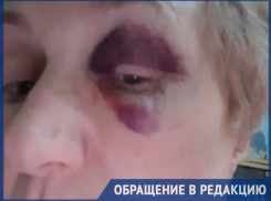 Женщину избили среди бела дня на одной из столичных улиц