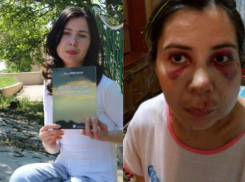 Поэтессу из Чимишлии сбили на пешеходном переходе и не оказали нормальной медицинской помощи