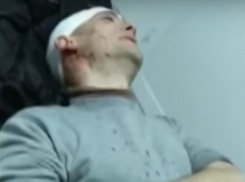 Жестокую расправу за комментарии в Сети устроили жителю Хынчешт его знакомые