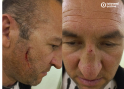 Электоральные разборки в Костештах: примар дал кулаком в лицо местному советнику