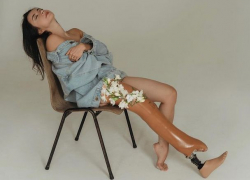 Виктория Суручану – история девушки, показавшей безумную волю к жизни