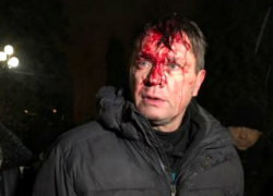 Штурм лагеря Саакашвили в Киеве превратился в жестокое кровавое побоище