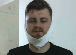 Драма абсурда: националисты сломали челюсть воевавшему в Донбассе за крик «Слава Украине!»