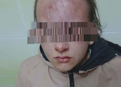 Минобразования отреагировало на резонансное нападение на школьницу