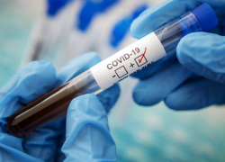 В Молдове +954 новых случая COVID-19 за сутки