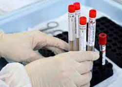 В Молдове выявлено 2057 новых случаев COVID-19   