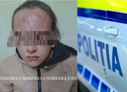 В Яловенском районе 13-летняя девочка была избита малолетками: возбуждено уголовное дело