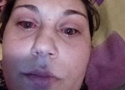 Роженица в эфире телеканала обвинила врачей в травмировании ее дочери и циничном отношении к пациенткам