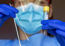 В Молдове выявлено 497 новых случаев COVID-19  