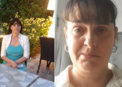 У жительницы столицы после стоматологических процедур отнялась часть лица