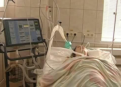 Ревнивый любовник жестоко избивал девушку, пока она не впала в кому