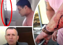 Кровавое избиение активиста, приехавшего за овчаркой, совершили в "Некрополе для животных"