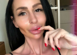 Секс-бомба Playboy превратилась в монстра после пластических операций