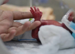 Молдавские врачи спасли ребенка с экстремально низким весом