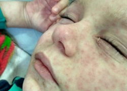 Разъяренные мамы заболевших корью украинских детей атаковали известный цирк