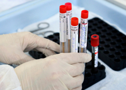 Абсолютный антирекорд этого лета! +345 новых случаев COVID-19  за сутки